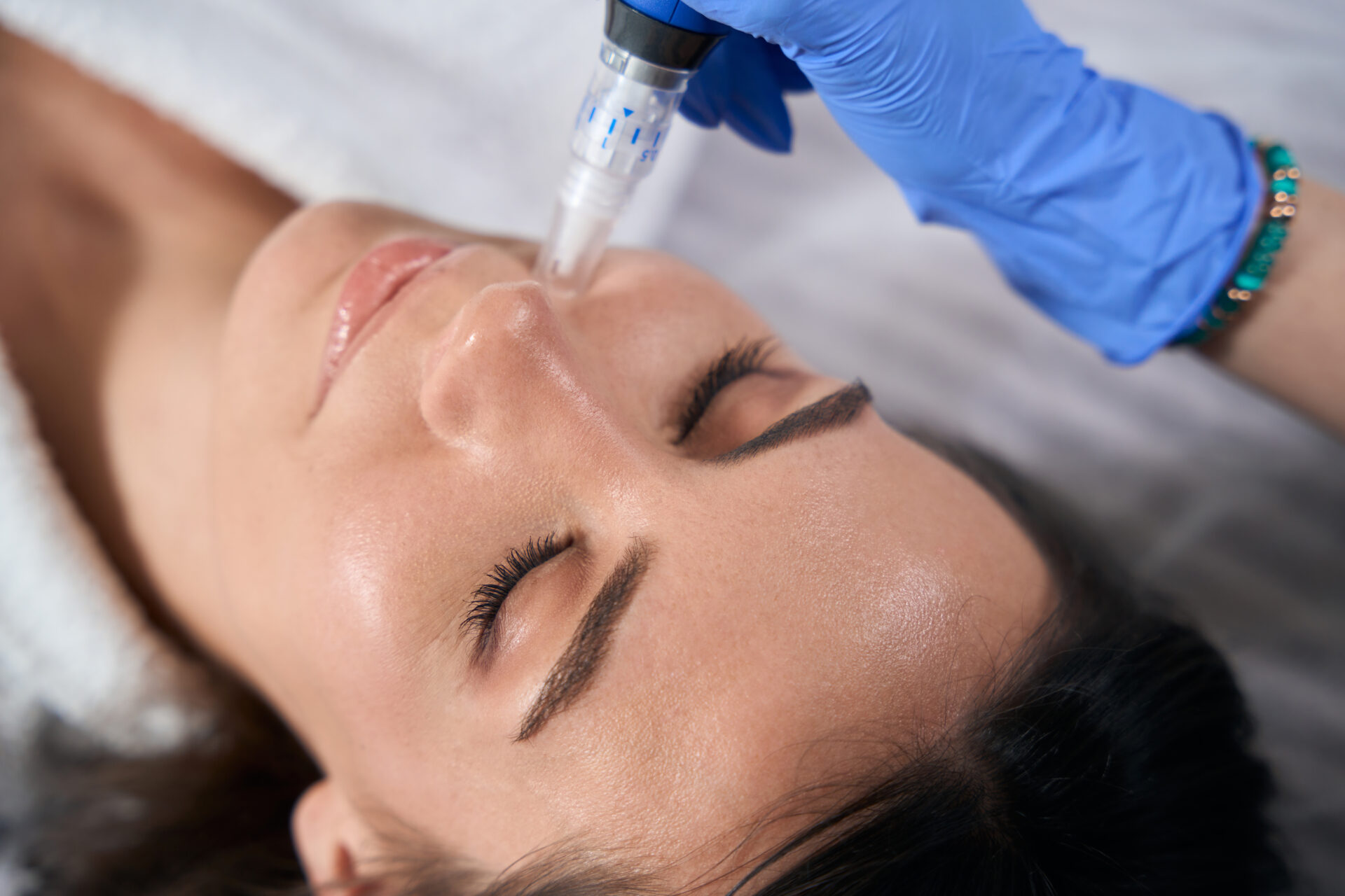 Close up of a woman during a microneedling session to help fade scars and increase collagen production.